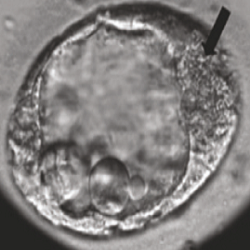 ivf success story of poor quality embryo (picture) that worked