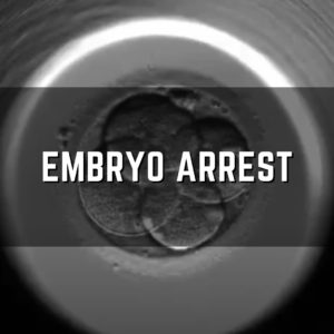 embryo arrest