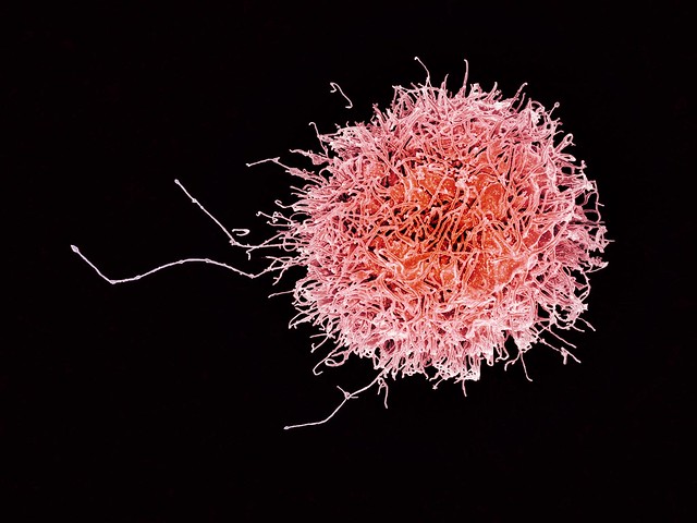 a SEM of a natural killer cell