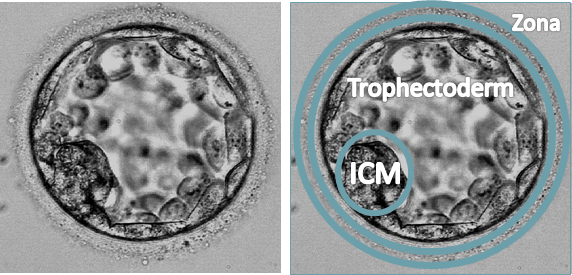 Blastocyst ICM inner cell mass trophectoderm and zona