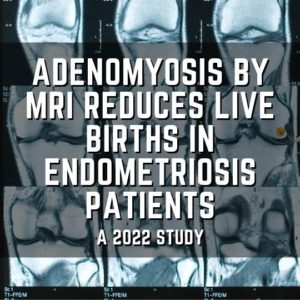 Adenomyosis by MRI reduces live births in endometriosis patients