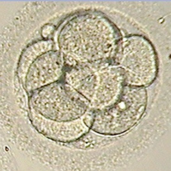 A good quality 3/8 day 3 embryo