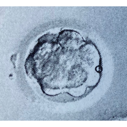 a morula embryo picture