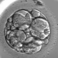 A poor quality 1/8 day 3 embryo