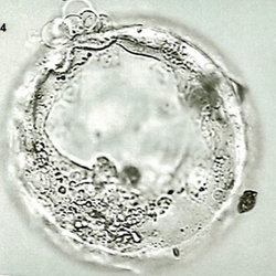 A 5CC poor quality blastocyst