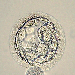 An early blastocyst graded as a 2