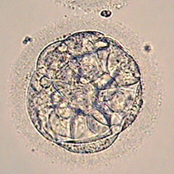 An early blastocyst graded as a 1