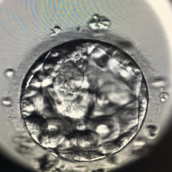 A 3CB expanded good quality blastocyst