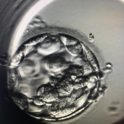 A 3BB expanded good quality blastocyst