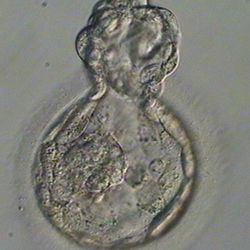 A 5AB hatching good quality blastocyst