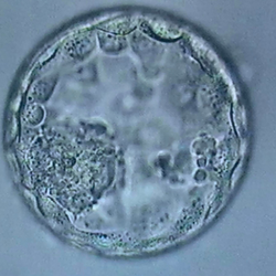A 4AA expanded good quality blastocyst