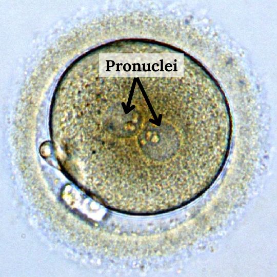 pronuclei (plural) from a fertilized egg