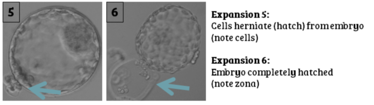 embryo hatching from zona