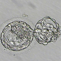 assisted hatched embryo graded as a 5BA