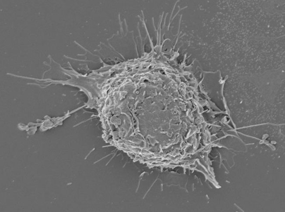 Electron micrograph of a macrophage