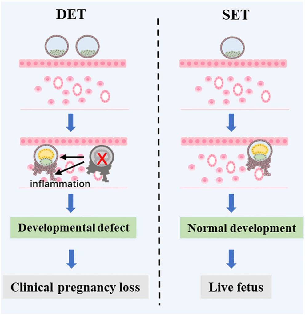 Illustration that shows how a DET can lead to a pregnancy loss, due to inflammation that harms the surviving embryo