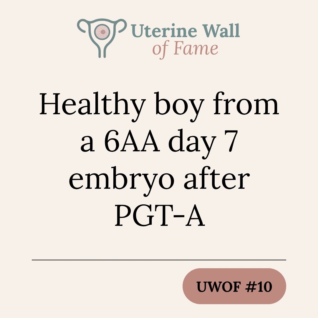 Healthy boy from a 6AA day 7 embryo after PGT-A