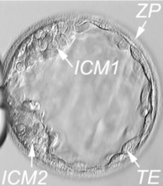 image showing a blastocyst with two separate ICMs that may split