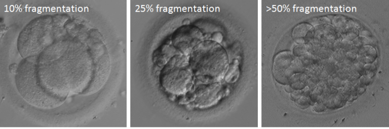 image showing higher embryo fragmentation in cleavage stage embryos ivf